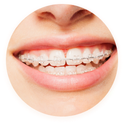 Showcase Photo For Mini Twin Brackets