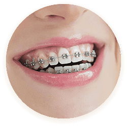 Showcase Photo For Mini Twin Brackets